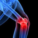 My Experience with Pain: A Physiotherapy Student’s Perspective